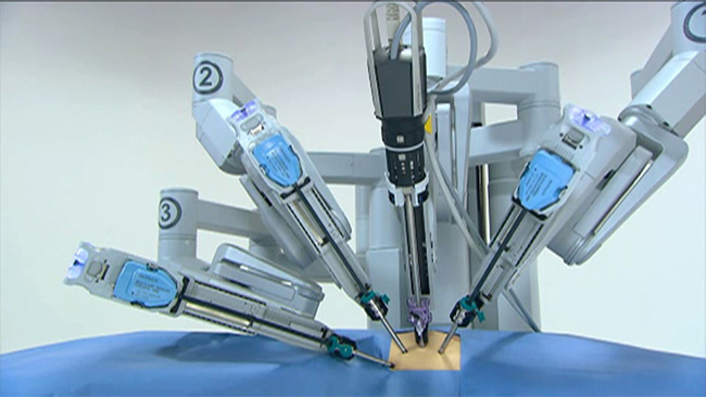 weight-loss-robotic-surgery-mumbai