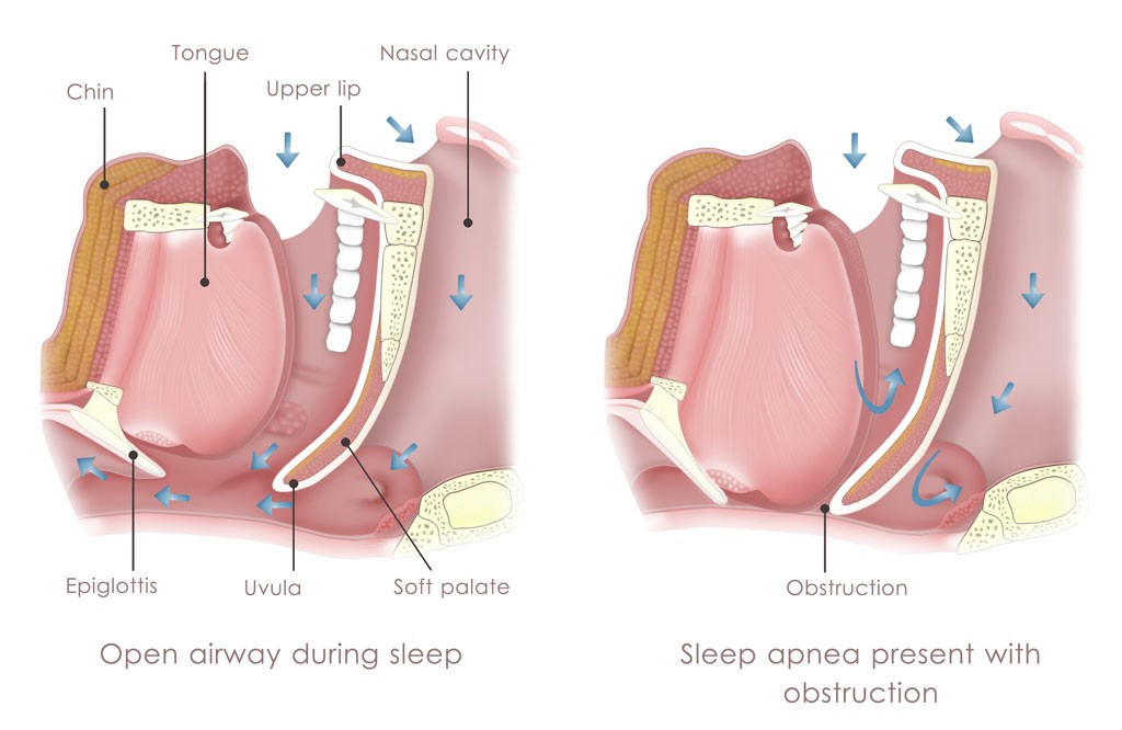 sleep-disorder-treatments